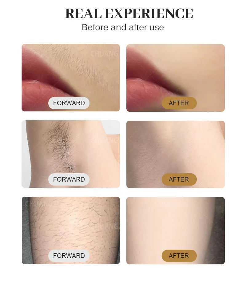 Ice Titanium Laser Hair Removal Machine, Permanent Removal