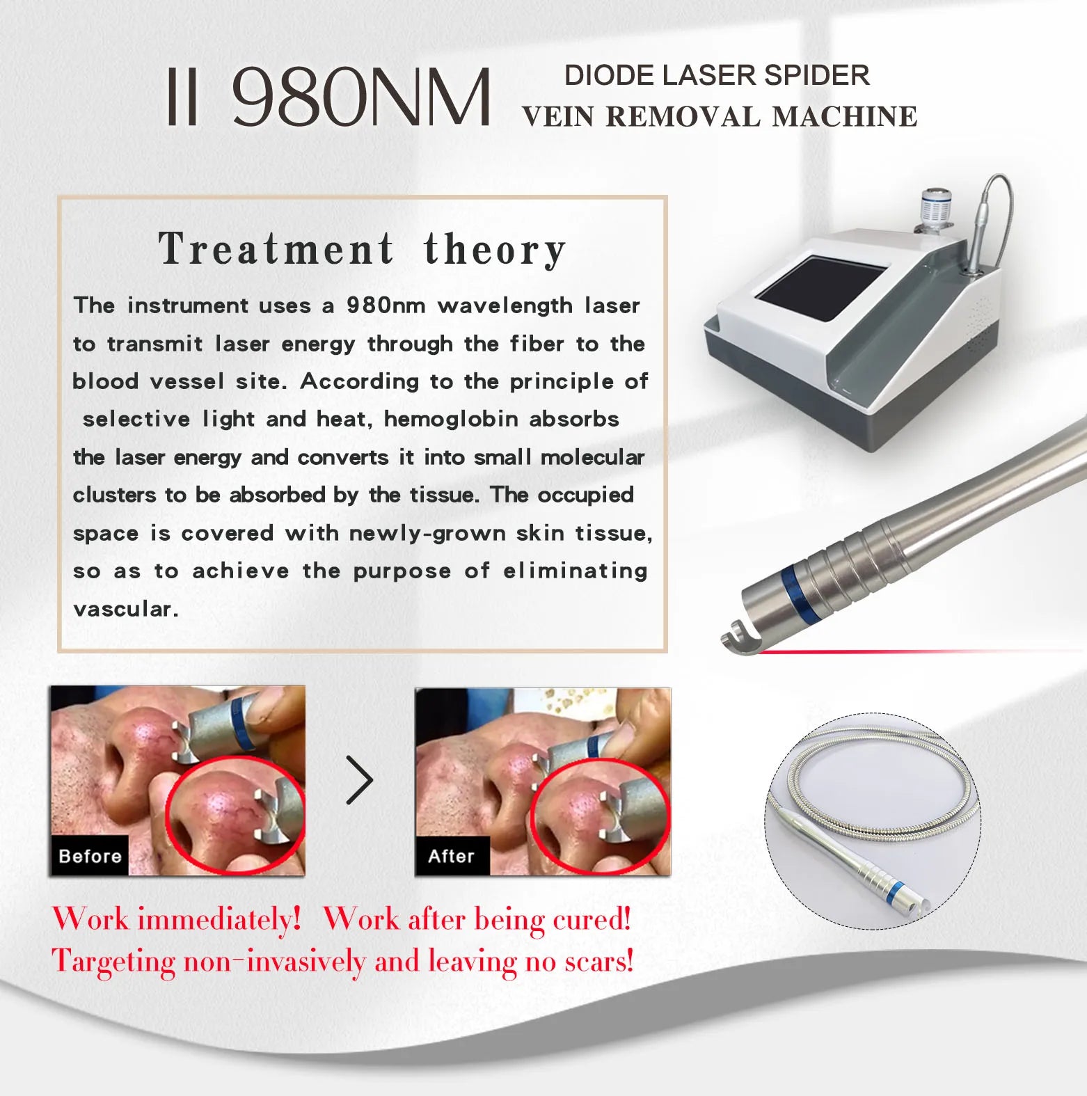 5 In 1 980nm Diode Laser, Nail Fungus, Spider Veins