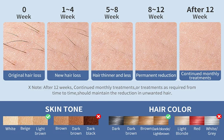 Laser Home Use Painless Epilator For Women Men