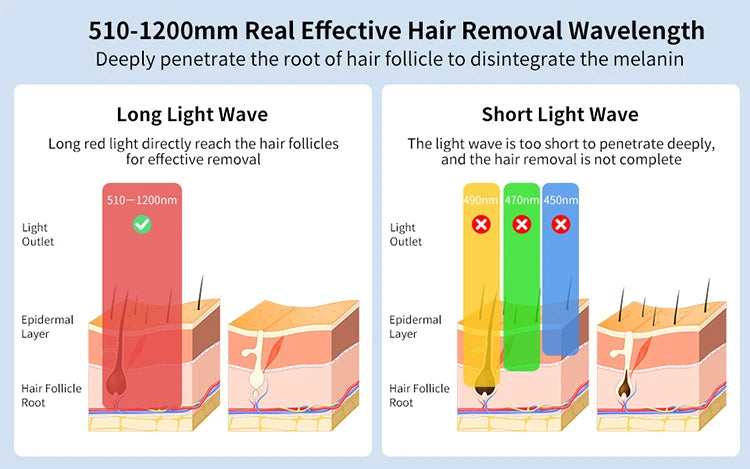 Laser Home Use Painless Epilator For Women Men