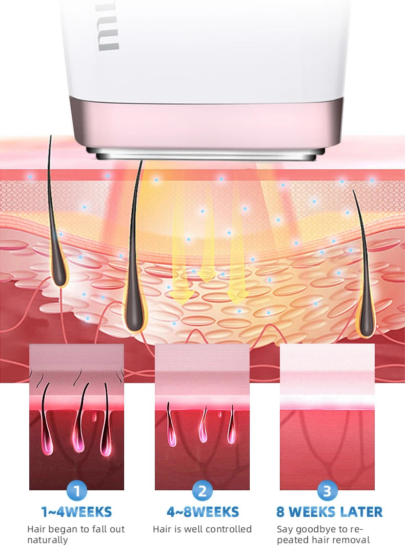 Laser Hair Removal Device, Painless