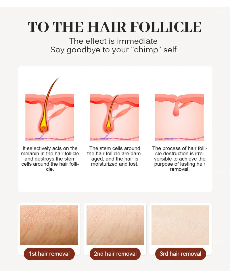 Ice Titanium Laser Hair Removal Machine, Permanent Removal